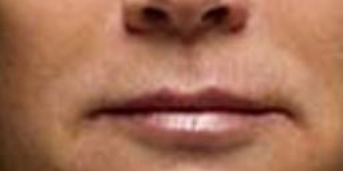 Best PRP Treatment in Chandigarh for Hair Regrowth & Skin Renewal