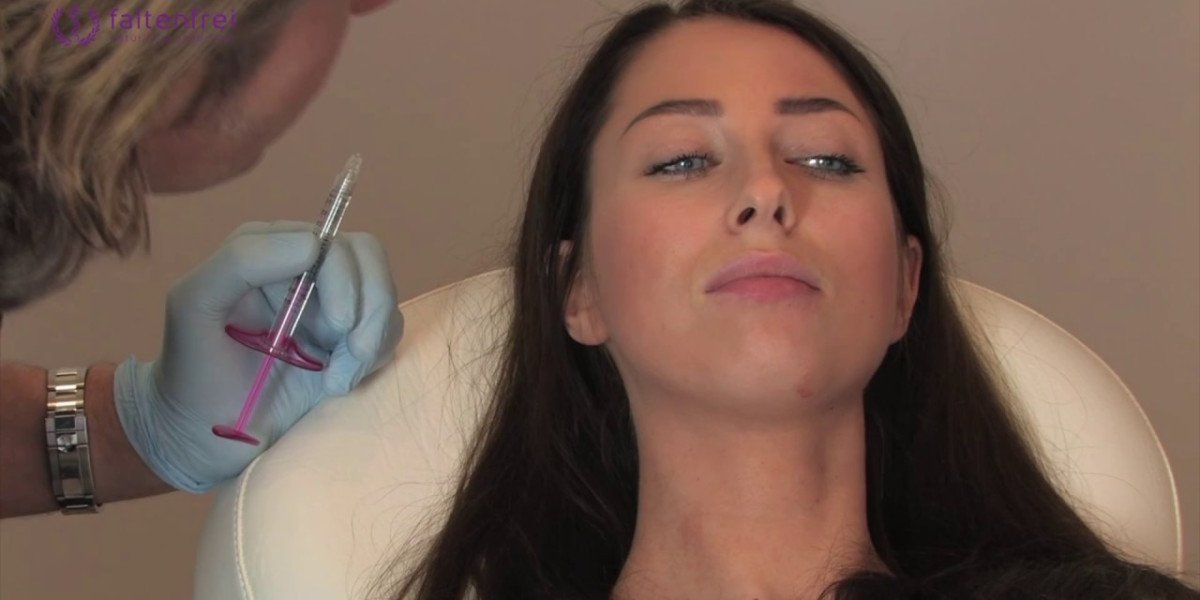 Alles, was Sie über lippen aufspritzen schweiz wissen müssen