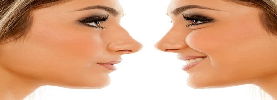 Rhinoplasty in Riyadh Cover Image