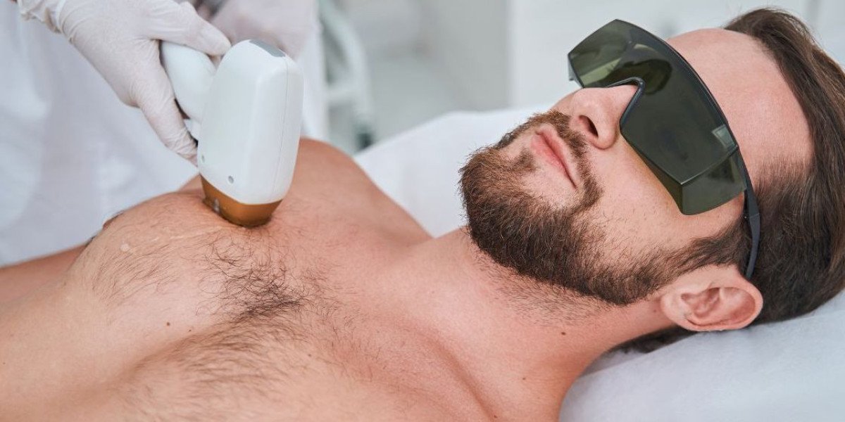 Laser Hair Removal in Islamabad: The Modern Choice for Long-Lasting Smooth Skin