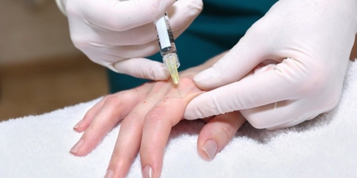 CO2 Hand Rejuvenation: Safe Way to Younger Looking Hands?