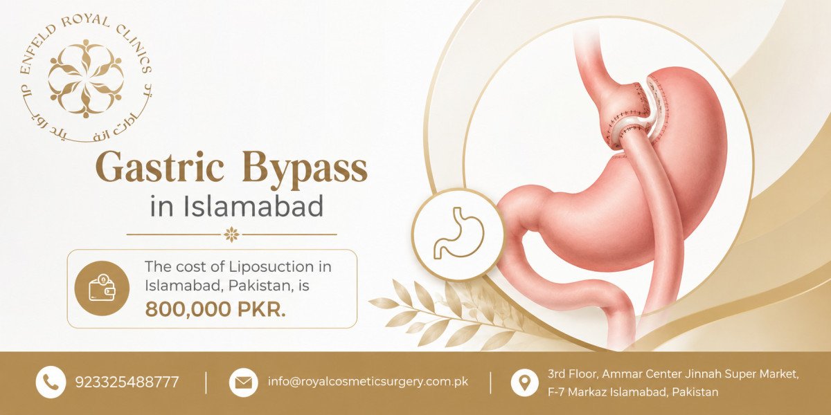 Your Complete Gastric Bypass Guide